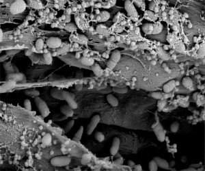 pseudomonas6_