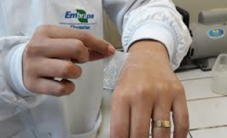 Um produto gerado na indústria do papel e celulose pode ajudar no tratamento de queimaduras