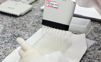 Alerta para a tuberculose bovina, uma grave doença que atinge animais e humanos