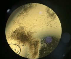 Identificadas as bactérias que ajudam a reduzir o ataque de fungos nas plantações de trigo